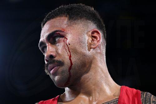 epa13133002 Dee Ioapo of Samoa bleeds during the Men's 80kg Round of 32 match against Daniel Pitt of Wales on day two of the Glasgow 2026 Commonwealth Games at the SEC Centre in Glasgow, Scotland, 25 July 2026.  EPA/JOEL CARRETT AUSTRALIA AND NEW ZEALAND OUT