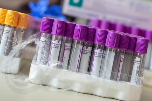 Πρώτη η Κύπρος παγκόσμια σε εθελοντές αιμοδότες, συζήτηση για κίνητρα στην Επ. Εργασίας