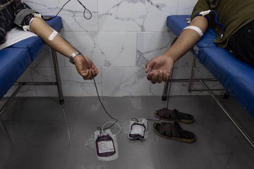 Ασφαλής η πλασμαφαίρεση όταν εφαρμόζεται με τις σωστές ενδείξεις, λέει η Νεφρολογική Εταιρεία