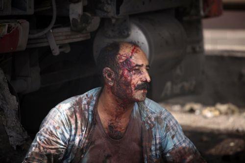 Τουλάχιστον 4 νεκροί από έκρηξη στο λιμάνι της Μπαντάρ Αμπάς στο Ιράν