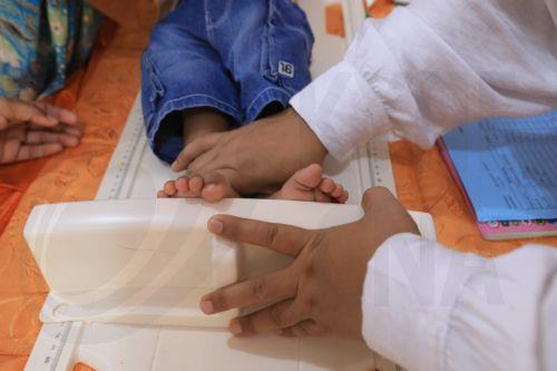 Ένας στους 5 θανάτους παιδιών διεθνώς συνδέεται με ανεπαρκή ανάπτυξη λέει μελέτη